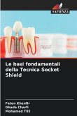 Le basi fondamentali della Tecnica Socket Shield
