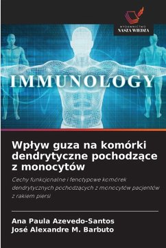 Cover Wp¿yw guza na komórki dendrytyczne pochodz¿ce z monocytów