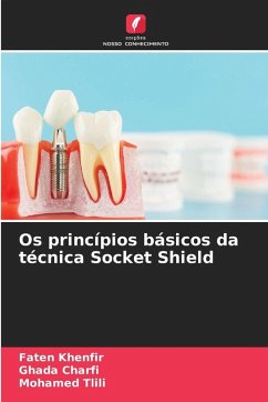 Cover Os princípios básicos da técnica Socket Shield