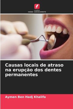 Cover Causas locais de atraso na erupção dos dentes permanentes