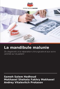 Cover La mandibule malunie