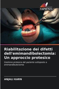 Riabilitazione dei difetti dell'emimandibolectomia: Un approccio protesico - KARN, ANJALI