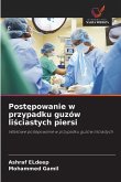 Post¿powanie w przypadku guzów li¿ciastych piersi