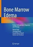 Bone Marrow Edema (eBook, PDF)