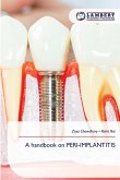 A handbook on PERI-IMPLANTITIS