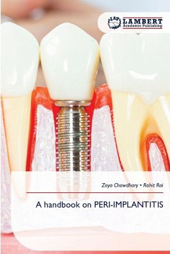 Cover A handbook on PERI-IMPLANTITIS