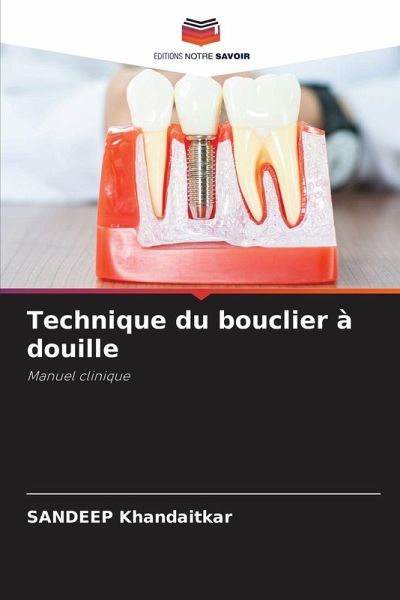 Technique du bouclier à douille Technique du bouclier à douille