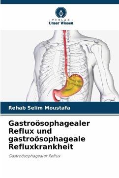 Cover Gastroösophagealer Reflux und gastroösophageale Refluxkrankheit