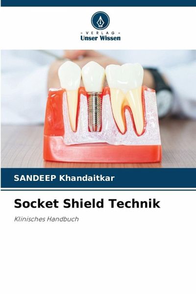 Socket Shield Technik Socket Shield Technik