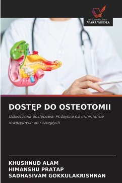 DOST¿P DO OSTEOTOMII - ALAM, KHUSHNUD;PRATAP, HIMANSHU;Gokkulakrishnan, Sadhasivam