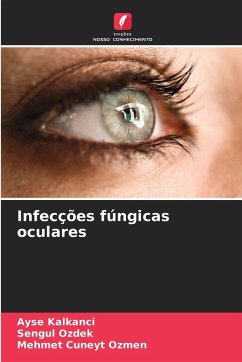 Infecções fúngicas oculares - Kalkanci, Ayse;Ozdek, Sengul;Ozmen, Mehmet Cuneyt