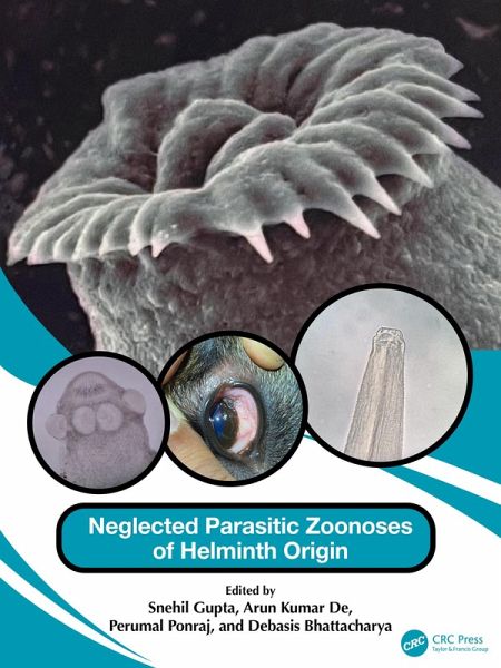 Neglected Parasitic Zoonoses of Helminth Origin (eBook, ePUB) Neglected Parasitic Zoonoses of Helminth Origin (eBook, ePUB)