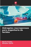 Hidrogeles macroporosos para engenharia de tecidos