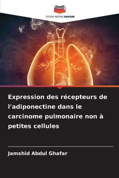 Expression des récepteurs de l'adiponectine dans le carcinome pulmonaire non à petites cellules - Abdul Ghafar, Jamshid Expression des récepteurs de l'adiponectine dans le carcinome pulmonaire non à petites cellules - Abdul Ghafar, Jamshid