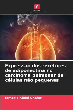 Cover Expressão dos recetores de adiponectina no carcinoma pulmonar de células não pequenas