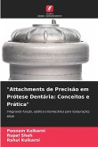 "Attachments de Precisão em Prótese Dentária: Conceitos e Prática"