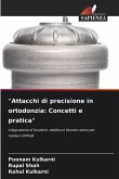 "Attacchi di precisione in ortodonzia: Concetti e pratica"