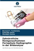 Zahnärztliche Röntgenaufnahmen Periapikale Radiographie in der Bildanalyse Zahnärztliche Röntgenaufnahmen Periapikale Radiographie in der Bildanalyse