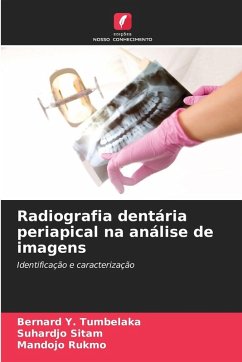Cover Radiografia dentária periapical na análise de imagens
