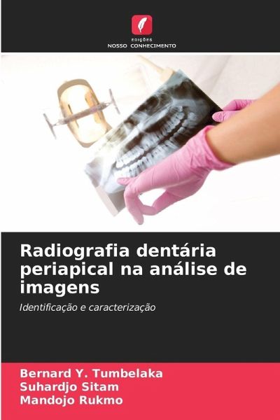 Radiografia dentária periapical na análise de imagens Radiografia dentária periapical na análise de imagens