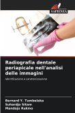 Radiografia dentale periapicale nell'analisi delle immagini