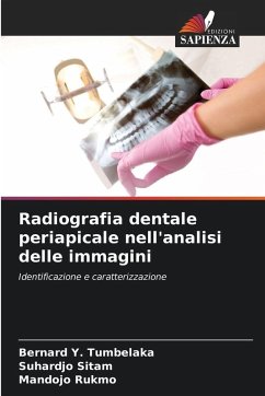Cover Radiografia dentale periapicale nell'analisi delle immagini