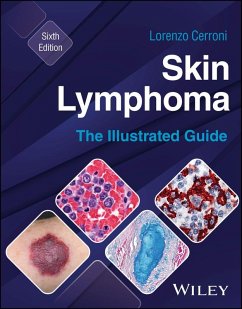 Cover Skin Lymphoma (eBook, ePUB)