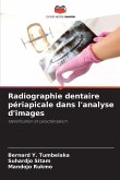Radiographie dentaire périapicale dans l'analyse d'images
