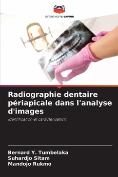 Cover Radiographie dentaire périapicale dans l'analyse d'images