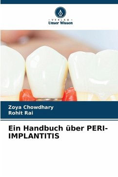 Ein Handbuch über PERI-IMPLANTITIS - Chowdhary, Zoya;Rai, Rohit Ein Handbuch über PERI-IMPLANTITIS - Chowdhary, Zoya;Rai, Rohit