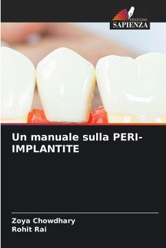 Un manuale sulla PERI-IMPLANTITE - Chowdhary, Zoya;Rai, Rohit Un manuale sulla PERI-IMPLANTITE - Chowdhary, Zoya;Rai, Rohit