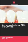 Um manual sobre a PERI-IMPLANTITE