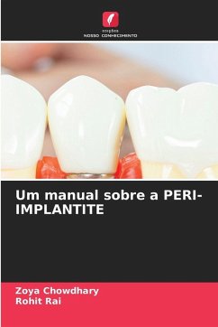 Um manual sobre a PERI-IMPLANTITE - Chowdhary, Zoya;Rai, Rohit Um manual sobre a PERI-IMPLANTITE - Chowdhary, Zoya;Rai, Rohit