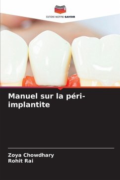 Manuel sur la péri-implantite - Chowdhary, Zoya;Rai, Rohit Manuel sur la péri-implantite - Chowdhary, Zoya;Rai, Rohit