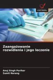 Zaanga¿owanie rozwidlenia i jego leczenie