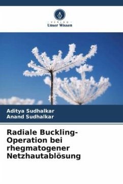 Cover Radiale Buckling-Operation bei rhegmatogener Netzhautablösung