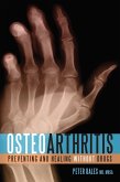 Osteoarthritis (eBook, ePUB)
