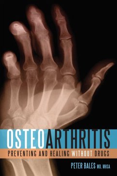 Osteoarthritis (eBook, ePUB) - Bales, Peter