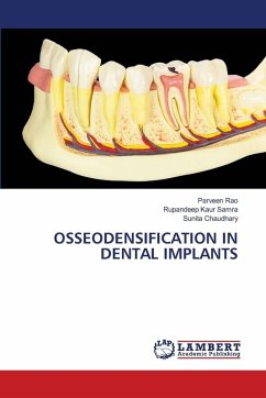 Cover OSSEODENSIFICATION IN DENTAL IMPLANTS