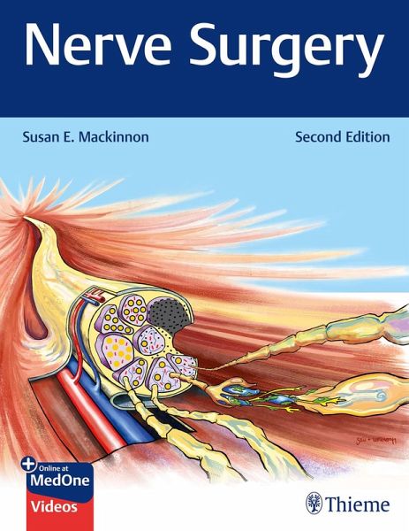 Nerve Surgery (eBook, ePUB)