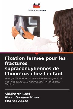 Cover Fixation fermée pour les fractures supracondyliennes de l'humérus chez l'enfant