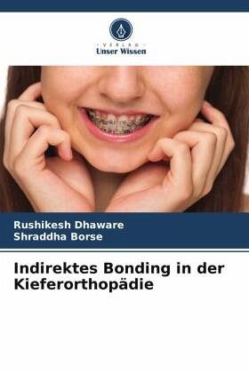 Indirektes Bonding in der Kieferorthopädie Indirektes Bonding in der Kieferorthopädie