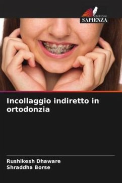 Cover Incollaggio indiretto in ortodonzia