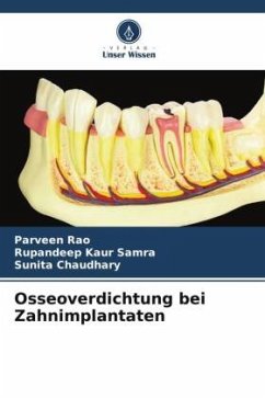 Cover Osseoverdichtung bei Zahnimplantaten
