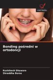 Bonding po¿redni w ortodoncji