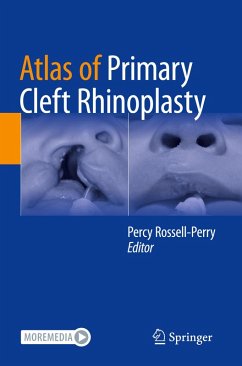Cover Atlas of Primary Cleft Rhinoplasty