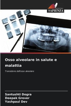 Osso alveolare in salute e malattia - Dogra, Santushti;Grover, Deepak;Dev, Yashpaul