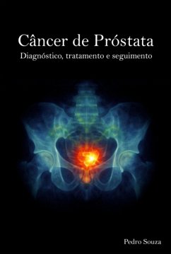 Câncer De Próstata (eBook, ePUB) - Souza, Pedro