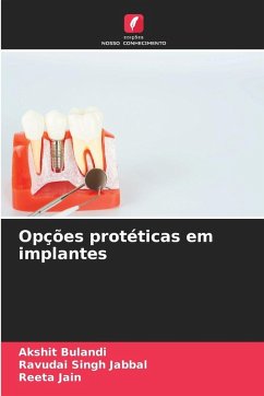 Opções protéticas em implantes - Bulandi, Akshit;Jabbal, Ravudai Singh;Jain, Reeta