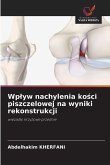 Wp¿yw nachylenia ko¿ci piszczelowej na wyniki rekonstrukcji